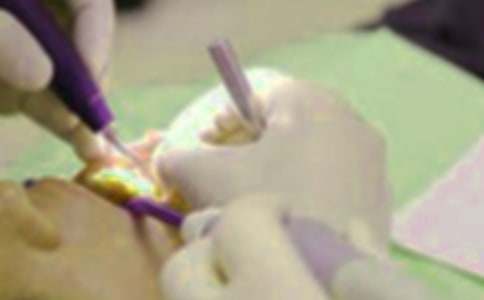 拔牙經(jīng)歷作文(精選20篇)